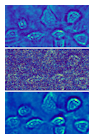 A hologram of fibroblast cells taken at a light intensity substantially above the shot-noise limit has relatively low noise (top). A shot-noise-limited hologram of the fibroblast cells has obvious high noise (center). A Holo-UNet-restored shot-noise-limited hologram has an image quality comparable to the hologram taken at a high intensity. These images are stills from an ANU video that can be found at https://youtu.be/nNkcdZsveHQ.