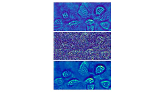 A hologram of fibroblast cells taken at a light intensity substantially above the shot-noise limit has relatively low noise (top). A shot-noise-limited hologram of the fibroblast cells has obvious high noise (center). A Holo-UNet-restored shot-noise-limited hologram has an image quality comparable to the hologram taken at a high intensity. These images are stills from an ANU video that can be found at https://youtu.be/nNkcdZsveHQ.