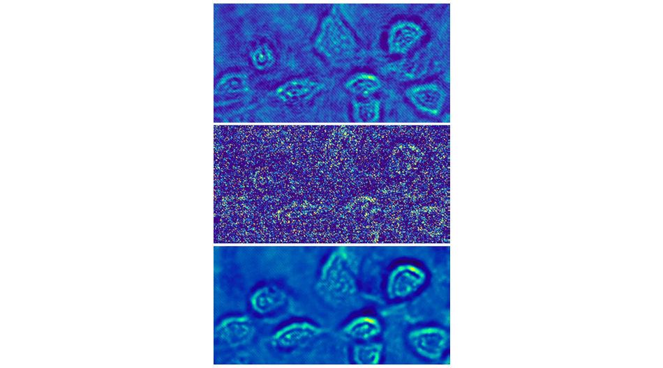 A hologram of fibroblast cells taken at a light intensity substantially above the shot-noise limit has relatively low noise (top). A shot-noise-limited hologram of the fibroblast cells has obvious high noise (center). A Holo-UNet-restored shot-noise-limited hologram has an image quality comparable to the hologram taken at a high intensity. These images are stills from an ANU video that can be found at https://youtu.be/nNkcdZsveHQ.
