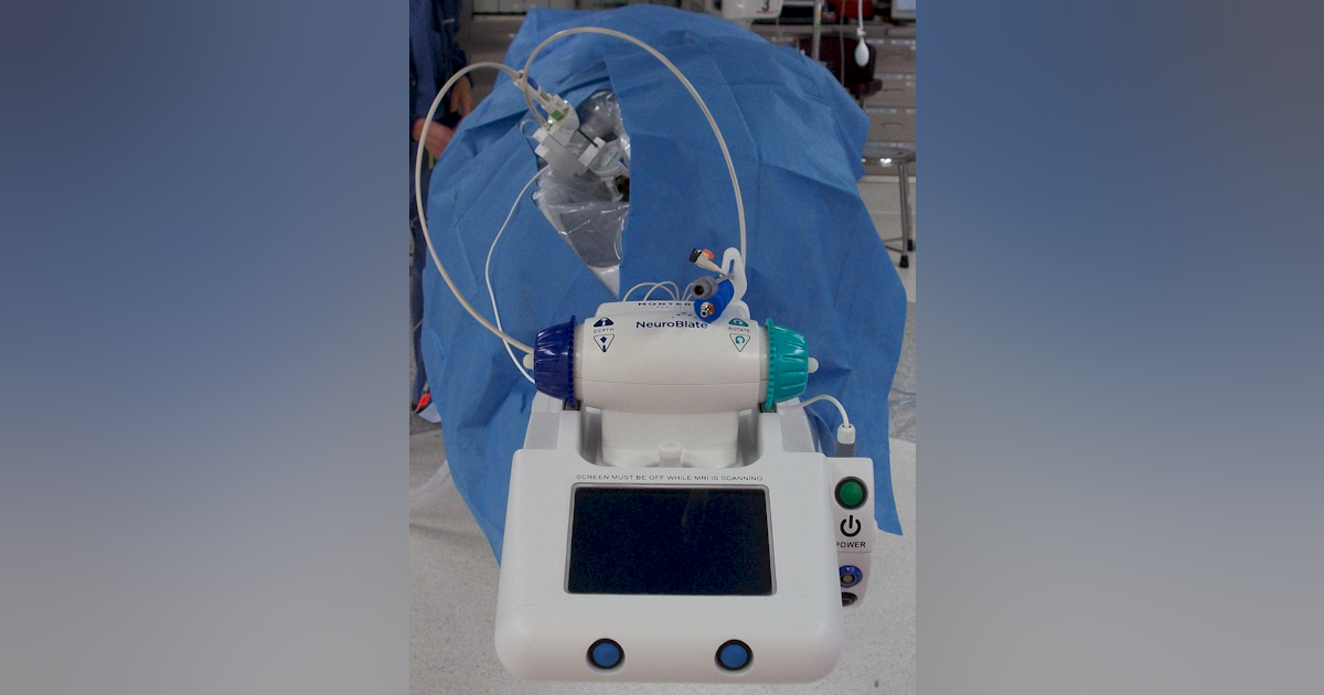 Neurosurgery: Laser neurosurgery tool wins excellence award | Laser ...