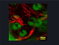 A stimulated-emission image of microcapillaries of a mouse ear based on endogenous hemoglobin contrast (in red color) shows individual blood cells in the vessel network surrounding sebaceous glands (green overlay based on confocal reflectance).