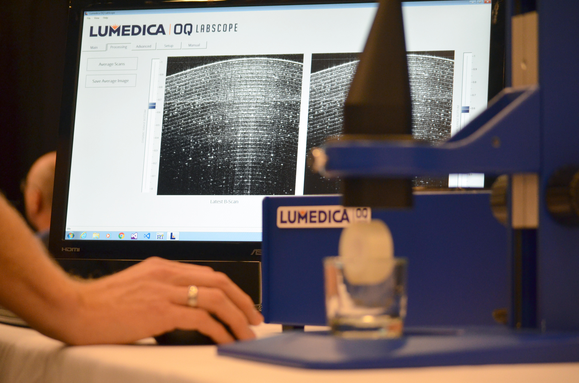 Lumedica says that its $10,000 OCT system performs on a par 'with machines costing $40,000 more.' OQ LabScope, the research version, is available now; the company is pursuing FDA approval for a clinical version that will target optometry practices currently unable to afford the technology.