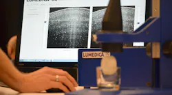 Lumedica says that its $10,000 OCT system performs on a par 'with machines costing $40,000 more.' OQ LabScope, the research version, is available now; the company is pursuing FDA approval for a clinical version that will target optometry practices currently unable to afford the technology.