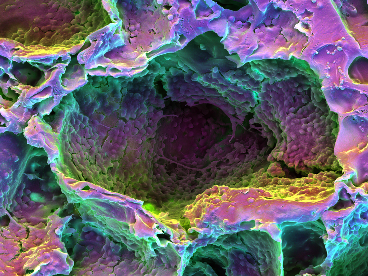 FIGURE 1. Arany and his colleagues researching light-facilitated dentin generation used poly-lactide-co-glycolide (PLG) scaffolding to assess three-dimensional differentiation of the subject's own stem cells.