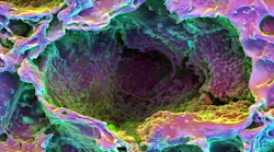 FIGURE 1. Arany and his colleagues researching light-facilitated dentin generation used poly-lactide-co-glycolide (PLG) scaffolding to assess three-dimensional differentiation of the subject's own stem cells.