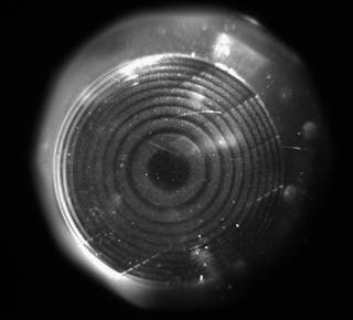 FIGURE 1. An Acuvue2 contact lens is inscribed with a +2.0D Fresnel lens refractive monofocal corrector and placed on a glass artificial cornea to photograph the pattern.