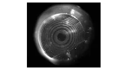 FIGURE 1. An Acuvue2 contact lens is inscribed with a +2.0D Fresnel lens refractive monofocal corrector and placed on a glass artificial cornea to photograph the pattern.