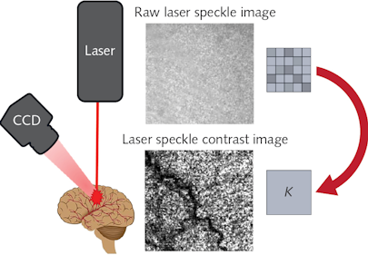 Stabilized Diodes Enable Improved Laser Speckle Contrast Imaging Laser Focus World