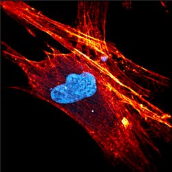 FIGURE 1. High-resolution multiphoton image of a human stem cell with ATTO-labeled actin and DAPI-labeled nucleus. FIGURE 1. High-resolution multiphoton image of a human stem cell with ATTO-labeled actin and DAPI-labeled nucleus.