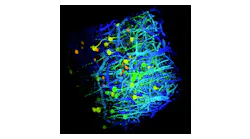Enabled by new light sources providing maximum flexibility for optimizing parameters, three-photon microscopy allows nondestructive imaging deep into a wide variety of specimens. This micrograph was acquired at 1330 nm (3 MHz) using a fiber laser designed to optimize three-photon fluorescence excitation in multiphoton imaging (KMLabs’ Y-Fi OPA); it shows mouse brain vasculature and neurons (labeled with fluorescein isothiocyanate-conjugated dextran and green fluorescent protein, respectively).