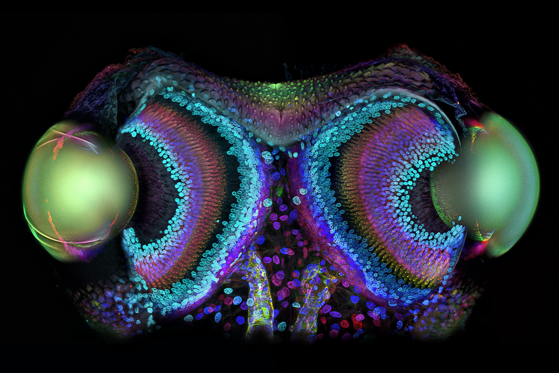 FIGURE 1. Dr. Igor Siwanowicz garnered First Prize for his image of a Daddy Longlegs taken using confocal microscopy. The sample was stained to visualize nuclei and F-actin, and shows not only the eyes' lenses (two large ovals), but also the retinas and optic nerves (trailing down at center back).