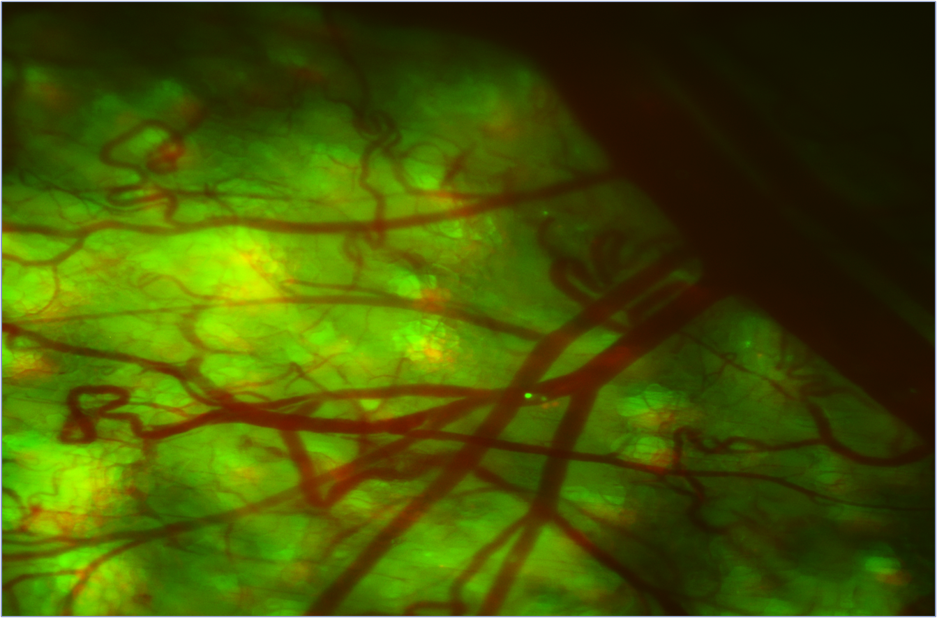FIGURE 1: Cellular trafficking of cancer cells within the vasculature of a mouse, which was imaged using UVP&rsquo;s iBox Explorer in-vivo imager. The imager uses off-the shelf achromatic lenses and other single lenses and filters to form multi-element objectives and tube lenses that can be mixed and matched to provide seven different magnifications. Filter combinations were optimized to ensure good signal-to-noise ratio for each color channel. The GFP-tagged nucleus of the Human HT-1080 fibrosarcoma cell can be seen migrating downstream from the injection site, passing the bifurcation of a distal vein (small green dot, down and to the right of center).