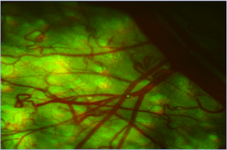 FIGURE 1: Cellular trafficking of cancer cells within the vasculature of a mouse, which was imaged using UVP’s iBox Explorer in-vivo imager. The imager uses off-the shelf achromatic lenses and other single lenses and filters to form multi-element objectives and tube lenses that can be mixed and matched to provide seven different magnifications. Filter combinations were optimized to ensure good signal-to-noise ratio for each color channel. The GFP-tagged nucleus of the Human HT-1080 fibrosarcoma cell can be seen migrating downstream from the injection site, passing the bifurcation of a distal vein (small green dot, down and to the right of center). FIGURE 1: Cellular trafficking of cancer cells within the vasculature of a mouse, which was imaged using UVP’s iBox Explorer in-vivo imager. The imager uses off-the shelf achromatic lenses and other single lenses and filters to form multi-element objectives and tube lenses that can be mixed and matched to provide seven different magnifications. Filter combinations were optimized to ensure good signal-to-noise ratio for each color channel. The GFP-tagged nucleus of the Human HT-1080 fibrosarcoma cell can be seen migrating downstream from the injection site, passing the bifurcation of a distal vein (small green dot, down and to the right of center).
