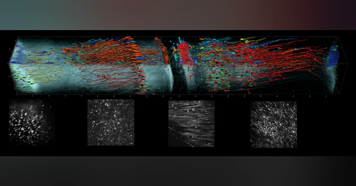 MICROSCOPY/DEEP TISSUE IMAGING: Deeper focus in microscopic bioimaging ...