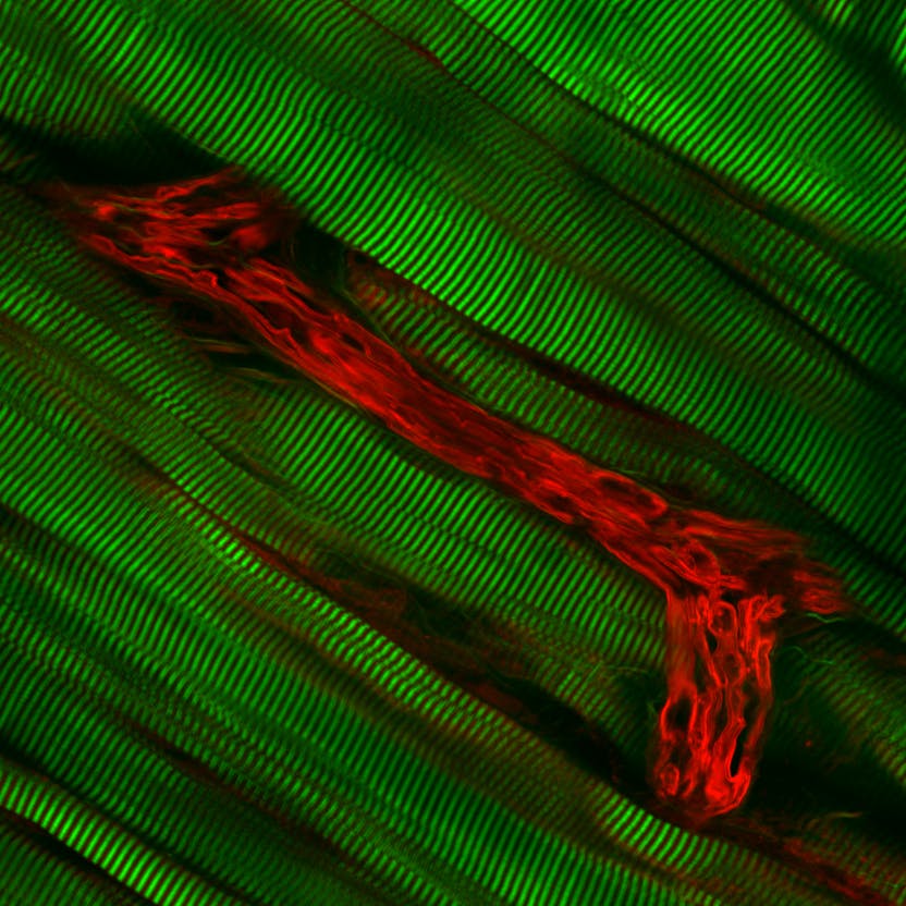 FIGURE 3. Using a Carl Zeiss LSM 7 MP OPO system, second-harmonic excitation generated a signal from striated muscle (green), and third-harmonic excitation produced a signal from a nerve&apos;s myelin sheath (red).