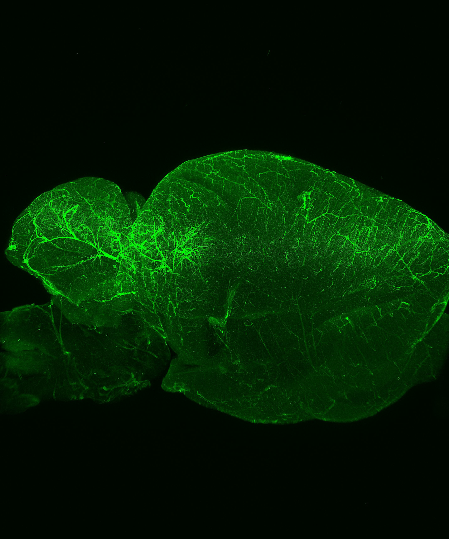 FLUORESCENCE MICROSCOPY/CELL BIOLOGY: The planar truth about light-sheet microscopy | Laser ...