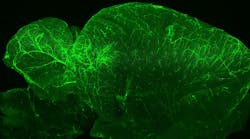 Light-sheet fluorescence microscopy (LSFM) optically sections samples and collects data for three-dimensional reconstructions, as shown in this mouse brain.