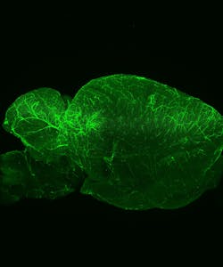 Light-sheet fluorescence microscopy (LSFM) optically sections samples and collects data for three-dimensional reconstructions, as shown in this mouse brain. Light-sheet fluorescence microscopy (LSFM) optically sections samples and collects data for three-dimensional reconstructions, as shown in this mouse brain.