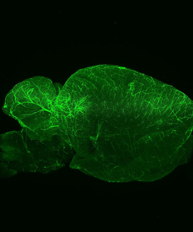 Light-sheet fluorescence microscopy (LSFM) optically sections samples and collects data for three-dimensional reconstructions, as shown in this mouse brain.