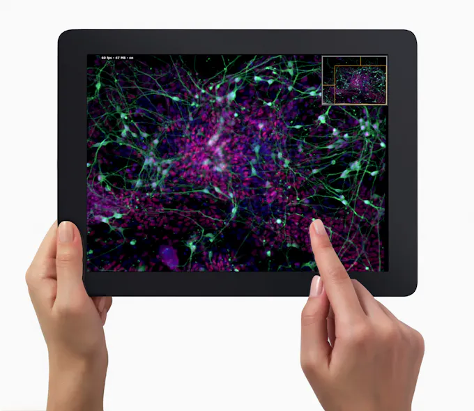 MICROSCOPY: Advancing microscopy with apps | Laser Focus World