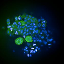 FIGURE 1. In this 3D InSight tumor microtissue from InSphero&mdash;a supplier of 3D microtissues for predictive drug testing&mdash;an image captured with the Opera Phenix shows expressed GFP (green) and Hoechst dye (blue) stains the nuclei.