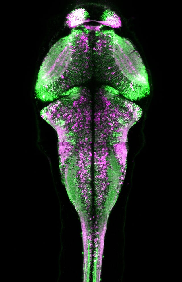 In this larval zebrafish brain, neurons that were active while the fish was swimming freely were permanently marked in magenta.
