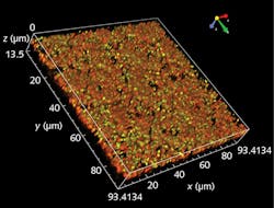 This isometric image of mouse retinal pigment epithelium was taken with 561 nm excitation and no emission filter on a modified confocal microscope. Green melanosomes are easily distinguished from golden-yellow lipofuscin granules. This isometric image of mouse retinal pigment epithelium was taken with 561 nm excitation and no emission filter on a modified confocal microscope. Green melanosomes are easily distinguished from golden-yellow lipofuscin granules.