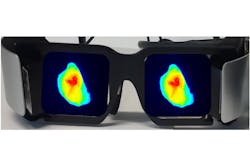 FIGURE 4. Researchers are leveraging commercial developments to create effective ways of displaying fluorescence images to the surgeon, as in these goggles showing a representative tumor fluorescence.