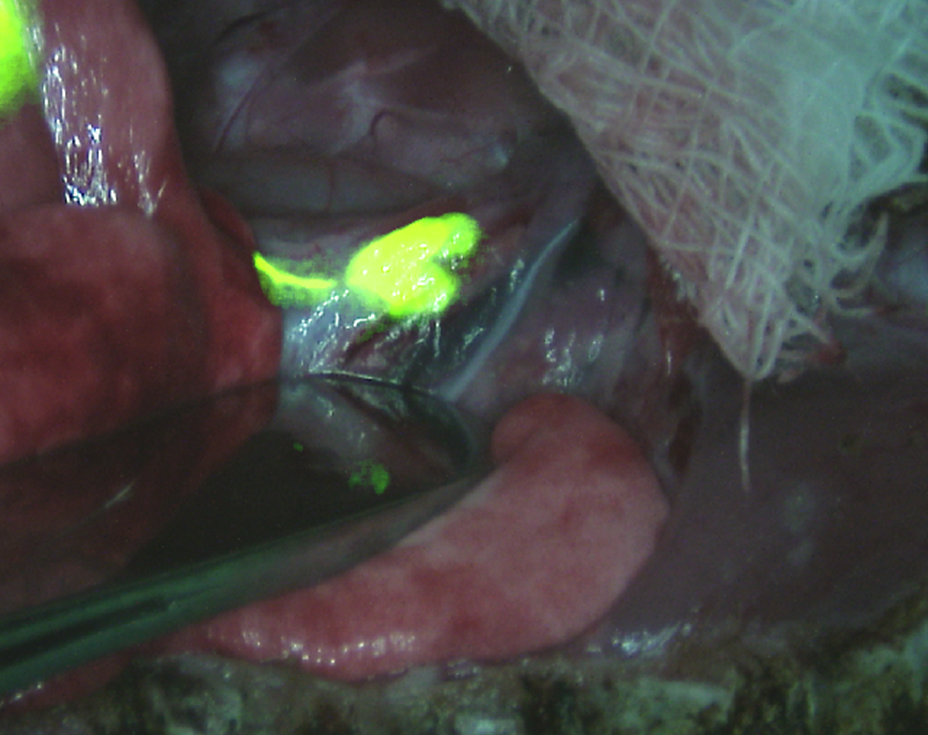 1101breaks Fig2 6033faf6cabe3