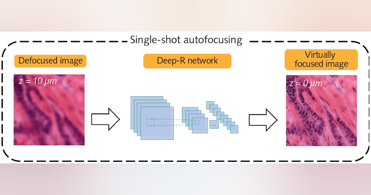 Deep learning enables single-shot autofocus in microscopy applications ...