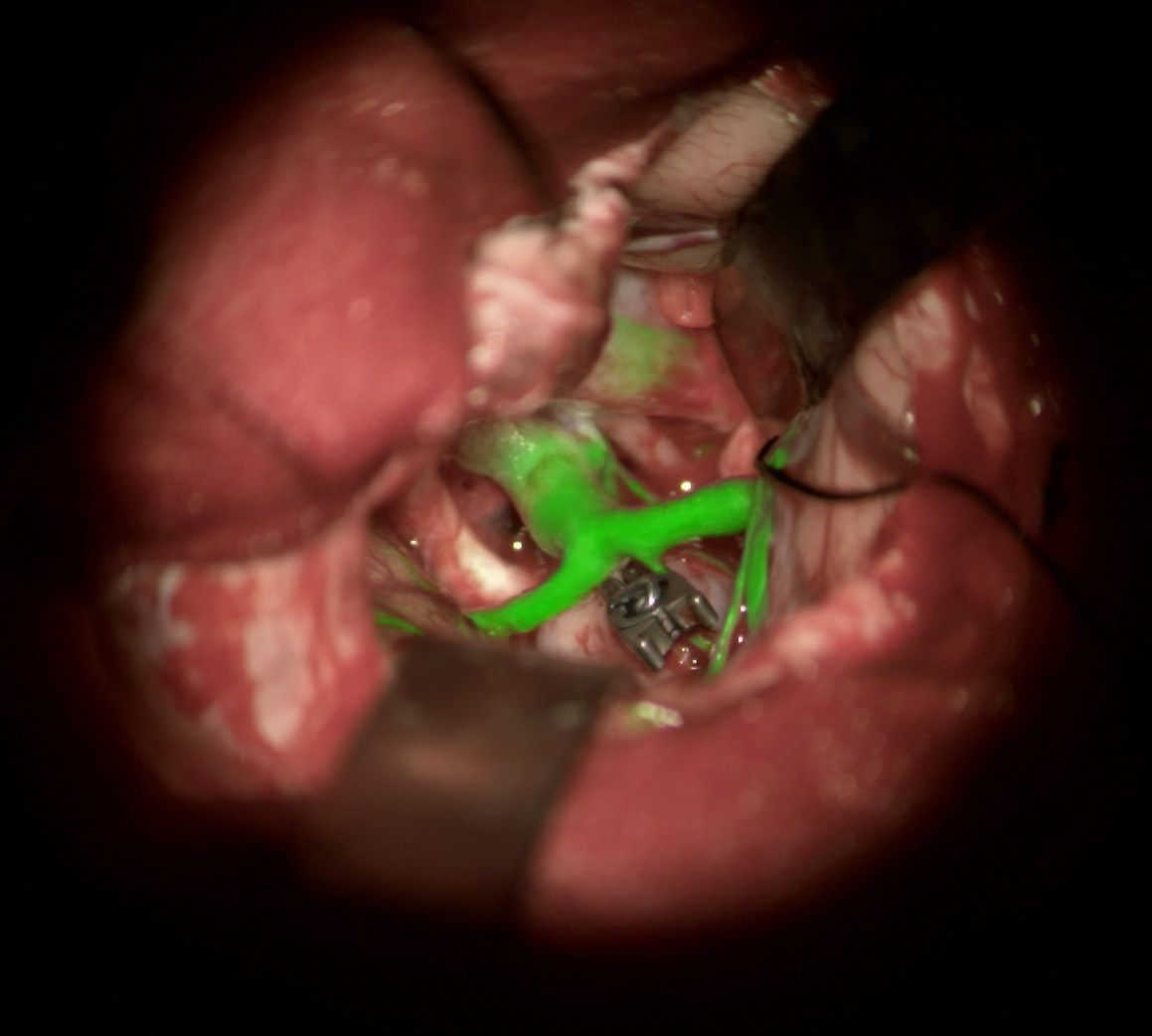 GLOW800 augmented reality fluorescence is shown.