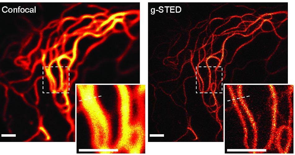 g-STED provides fundamentally improved spatial resolution over confocal microscopy in living cells. Here, the protein keratin is marked with the fluorescent protein Citrine in a living PtK2 cell. The insets show a magnified view of the marked areas, demonstrating the separation of features as small as 60 nm in the living cell. Fluorescence excitation occurred at 485 nm, while STED occurred at 592 nm using a CW beam. Scale bars = 1 &micro;m.