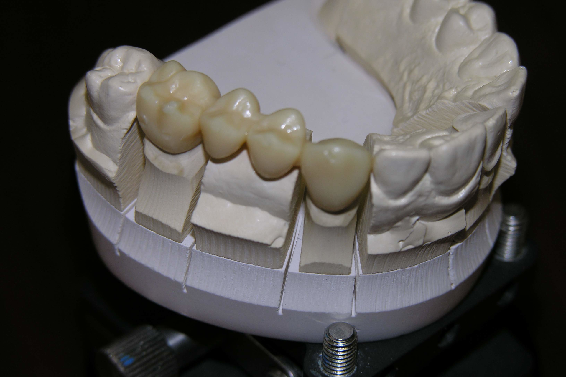 Digital light processing (DLP) technology used in concert with a laser-assisted manufacturing, rapid-prototyping process can speed dental and hearing aid implant manufacture by varying the illumination intensity (and corresponding cure depth) pixel-by-pixel in the fabrication process.