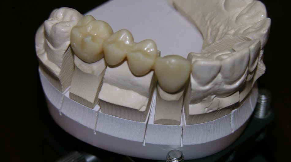 Digital light processing (DLP) technology used in concert with a laser-assisted manufacturing, rapid-prototyping process can speed dental and hearing aid implant manufacture by varying the illumination intensity (and corresponding cure depth) pixel-by-pixel in the fabrication process.