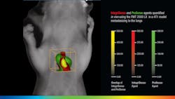 FIGURE 3. IntegriSense and ProSense fluorescence agents are quantified in 3D in vivo using the FMT 2500 LX quantitative tomography system in a mouse model with cancer metastasizing to the lung. FIGURE 3. IntegriSense and ProSense fluorescence agents are quantified in 3D in vivo using the FMT 2500 LX quantitative tomography system in a mouse model with cancer metastasizing to the lung.