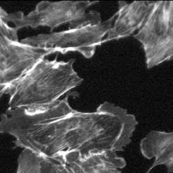 1005lfw4 Fig4breplace 1005lfw4 Fig4breplace