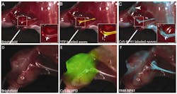 FIGURE 2: Two-color FIGS imaging in cancer resection: White light reflectance (a) and fluorescence images from an YFP-transgenic mouse (b), and Cy5-labeled peptide (NP41) labeled nerve branches (c). Enhanced visualization of the nerve branches buried below surrounding tissue is possible when the Cy5 long wavelength dye is used. The ability to use white-light reflectance imaging (d) in conjunction with two-color fluorescence imaging to simultaneously visualize a large tumor mass is possible, using a Cy5-labeled activatable cell penetrating peptide dendrimer (ACPPD) (e), and the tumor-engulfed nerve branches are labeled with FAM-NP41 (f). FIGURE 2: Two-color FIGS imaging in cancer resection: White light reflectance (a) and fluorescence images from an YFP-transgenic mouse (b), and Cy5-labeled peptide (NP41) labeled nerve branches (c). Enhanced visualization of the nerve branches buried below surrounding tissue is possible when the Cy5 long wavelength dye is used. The ability to use white-light reflectance imaging (d) in conjunction with two-color fluorescence imaging to simultaneously visualize a large tumor mass is possible, using a Cy5-labeled activatable cell penetrating peptide dendrimer (ACPPD) (e), and the tumor-engulfed nerve branches are labeled with FAM-NP41 (f).