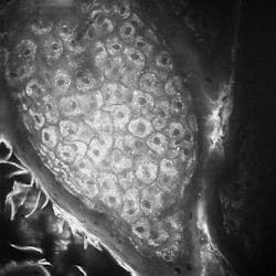 JenLab’s multiphoton tomography system produces incredible, cellular-resolution images of the skin. JenLab’s multiphoton tomography system produces incredible, cellular-resolution images of the skin.