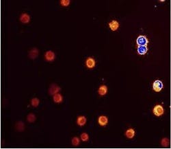 Confocal microscopy shows intense autofluorescence of neutrophils from control mice, excited at 364 nm. Confocal microscopy shows intense autofluorescence of neutrophils from control mice, excited at 364 nm.