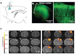FIGURE 1. An optogenetic functional magnetic resonance imaging (ofMRI) technique delivers 473 nm blue light to the motor cortex region of a rat’s brain (a). The channelrhodopsin (ChR2) expressing region in the brain is co-localized with the fluorescent tag as shown in the confocal microscopy images (b). A blood-oxygenation-level dependent (BOLD) signal appears in the light-activated brain (c; right) in the presence of ChR2, but not in the brain treated with a saline injection (c; left), indicating that selective stimulation of excitatory neurons expressing ChR2 is the source of the BOLD signal. FIGURE 1. An optogenetic functional magnetic resonance imaging (ofMRI) technique delivers 473 nm blue light to the motor cortex region of a rat’s brain (a). The channelrhodopsin (ChR2) expressing region in the brain is co-localized with the fluorescent tag as shown in the confocal microscopy images (b). A blood-oxygenation-level dependent (BOLD) signal appears in the light-activated brain (c; right) in the presence of ChR2, but not in the brain treated with a saline injection (c; left), indicating that selective stimulation of excitatory neurons expressing ChR2 is the source of the BOLD signal.