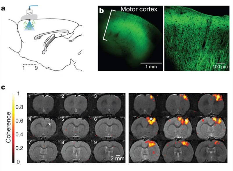 FIGURE 1. An optogenetic functional magnetic resonance imaging (ofMRI) technique delivers 473 nm blue light to the motor cortex region of a rat&rsquo;s brain (a). The channelrhodopsin (ChR2) expressing region in the brain is co-localized with the fluorescent tag as shown in the confocal microscopy images (b). A blood-oxygenation-level dependent (BOLD) signal appears in the light-activated brain (c; right) in the presence of ChR2, but not in the brain treated with a saline injection (c; left), indicating that selective stimulation of excitatory neurons expressing ChR2 is the source of the BOLD signal.