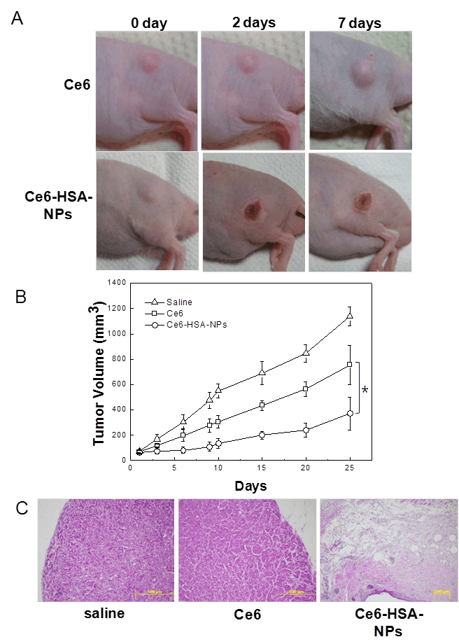 FIGURE 2. Photosensitized (with chlorine e6 or Ce6) human blood proteins (human serum albumin or HSA) can be used to image cancer cells and produce singlet oxygen upon exposure to radiation, visibly killing tumor cells. Images of in vivo photodynamic therapy (a) are shown after intravenous injection of both the control photosensitizer Ce6 and Ce6-HSA nanoparticles with 30 min irradiation of the tumor site with a 671 nm, 6 J/cm2 laser. Tumor growth data (b) is measured for 25 days. After 10 days of treatment, stained tumor tissue (c) confirms the tumor treated with Ce6-HAS nanoparticles is destroyed. Original magnification is 100X.