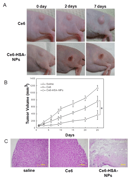 FIGURE 2. Photosensitized (with chlorine e6 or Ce6) human blood proteins (human serum albumin or HSA) can be used to image cancer cells and produce singlet oxygen upon exposure to radiation, visibly killing tumor cells. Images of in vivo photodynamic therapy (a) are shown after intravenous injection of both the control photosensitizer Ce6 and Ce6-HSA nanoparticles with 30 min irradiation of the tumor site with a 671 nm, 6 J/cm2 laser. Tumor growth data (b) is measured for 25 days. After 10 days of treatment, stained tumor tissue (c) confirms the tumor treated with Ce6-HAS nanoparticles is destroyed. Original magnification is 100X.