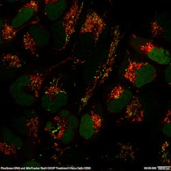FIGURE 2. Adding to the incredible value of HeLa cells, superresolution can be used to image intricacies working within the cell; here, DNA (green) and mitochondria (red) captured by the Olympus SD-OSR are shown. FIGURE 2. Adding to the incredible value of HeLa cells, superresolution can be used to image intricacies working within the cell; here, DNA (green) and mitochondria (red) captured by the Olympus SD-OSR are shown.