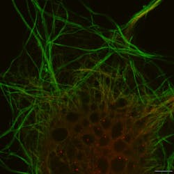 FIGURE 3. Actin filaments, like those shown here, make up complex networks that play important roles in cell shape and mitosis; image captured on the Olympus SD-OSR. FIGURE 3. Actin filaments, like those shown here, make up complex networks that play important roles in cell shape and mitosis; image captured on the Olympus SD-OSR.