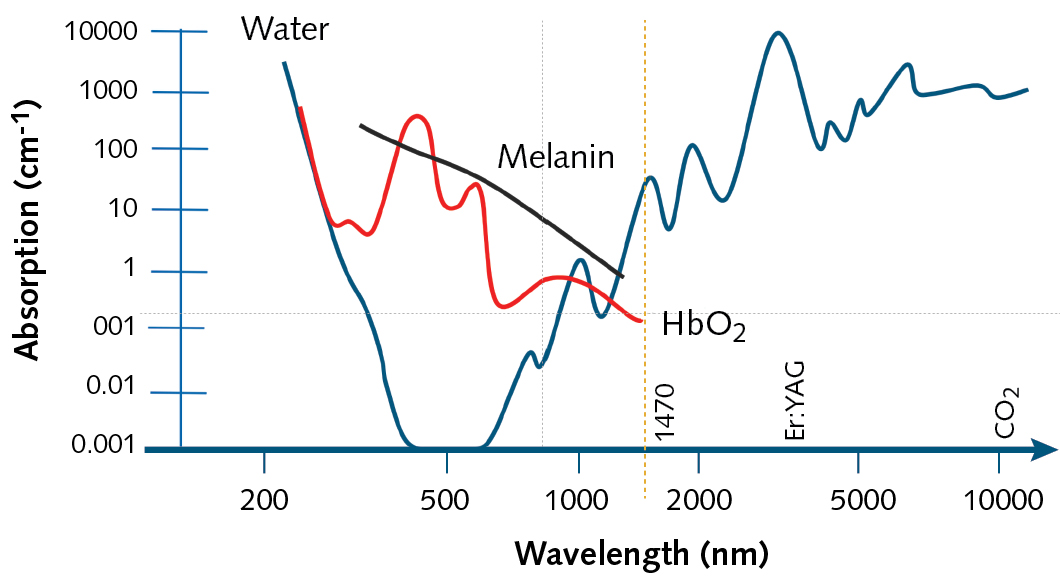 FIGURE 1. Lasers commonly used for fractional photothermolysis treatment have wavelengths highly absorbed by water and less absorbed by melanin and hemoglobin.