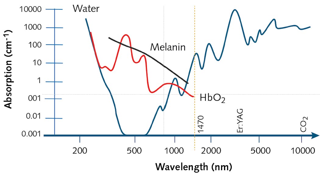 1470 nm diode lasers enable home skin rejuvenation Laser Focus World