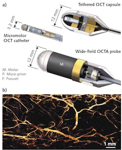 Fiber-coupled endoscopic probes scan surrounding tissue at high rates, enabled by a megahertz-range MEMS-VCSEL variable wavelength source (a). The high rates enable angiographic imaging without administering any contrast agent, as in the image of swine esophagus vasculature shown here (b). Fiber-coupled endoscopic probes scan surrounding tissue at high rates, enabled by a megahertz-range MEMS-VCSEL variable wavelength source (a). The high rates enable angiographic imaging without administering any contrast agent, as in the image of swine esophagus vasculature shown here (b).