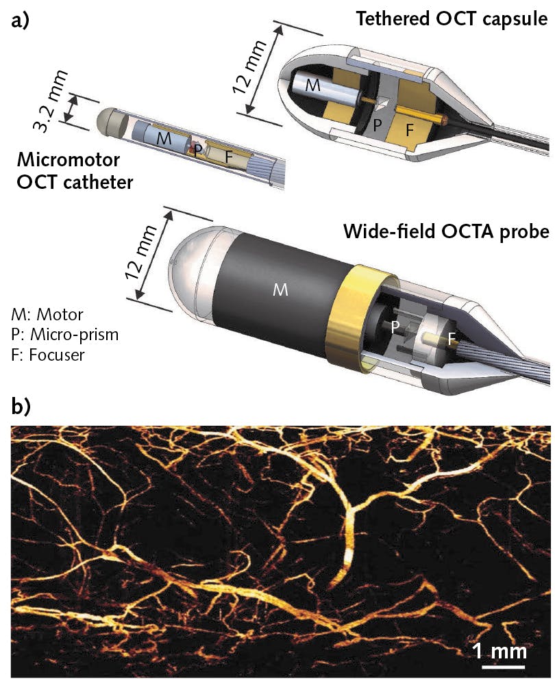 Fiber-coupled endoscopic probes scan surrounding tissue at high rates, enabled by a megahertz-range MEMS-VCSEL variable wavelength source (a). The high rates enable angiographic imaging without administering any contrast agent, as in the image of swine esophagus vasculature shown here (b).