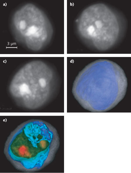 FIGURE 1. Two-dimensional (2D) maximum-intensity projections in different orientations are created from a 3D reconstruction of a squamous-cancer cell (a-c). The figure also shows the same cell from the perspective in (c), whole and cropped, where coloring and opacity have been adjusted to enhance cell features. In (d) and (e), cytoplasm is in translucent gray, the nuclear wall is in opaque blue, and the nucleoplasm is rendered in a green to red gradient, with nucleoli in opaque red.